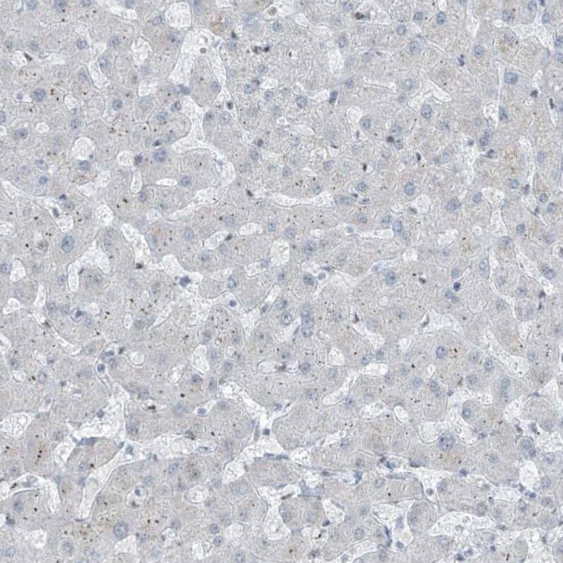 <b>Independent Antibodies Validation. </b>Staining of human liver shows no positivity in hepatocytes as expected.