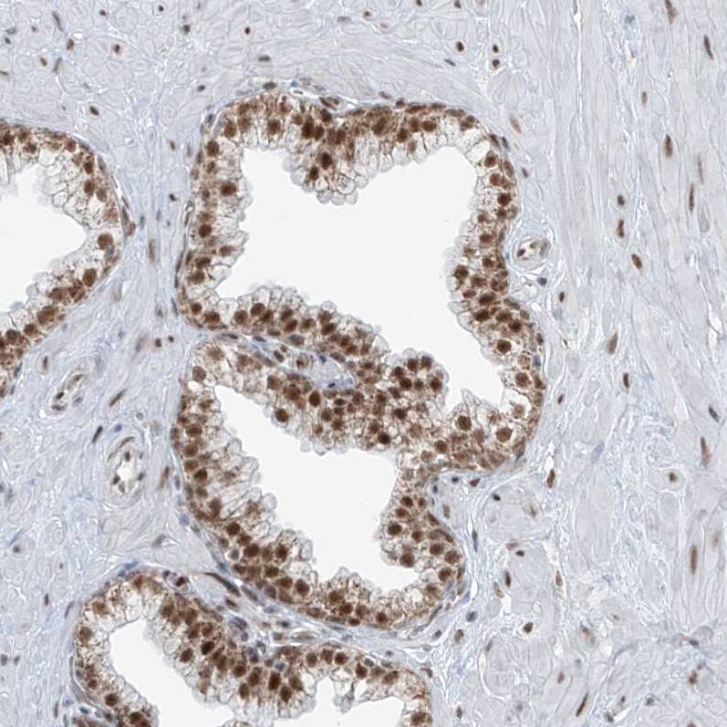 Staining of human prostate shows moderate nuclear positivity in glandular cells.