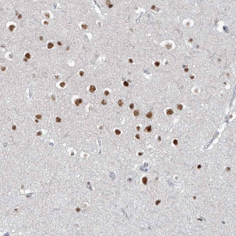 Staining of human cerebral cortex shows moderate nuclear positivity in neurons.