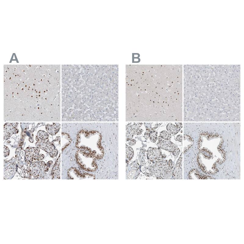 <b>Orthogonal Strategies Validation. </b>Staining of human cerebral cortex, liver, placenta and prostate HPA031752 (A) shows similar protein distribution across tissues to independent antibody HPA031753 (B).