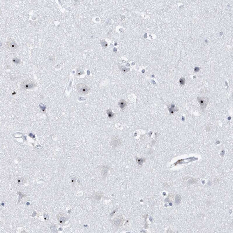 Immunohistochemistry-Paraffin BXDC1 Antibody - BSA Free
