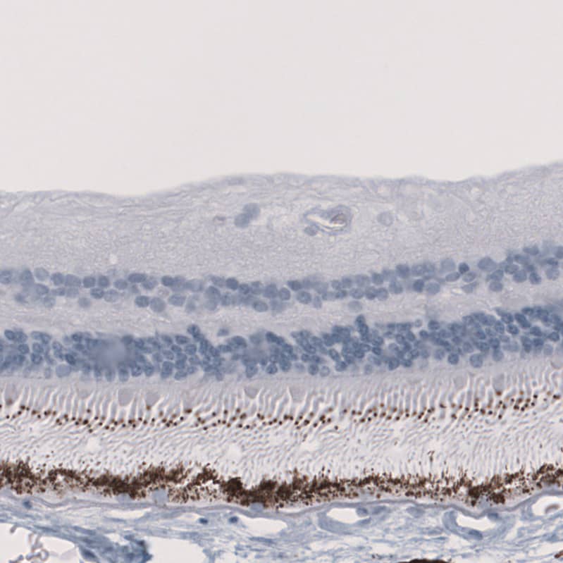 Staining of human eye retina shows strong positivity in the outer segments of rods and cones.