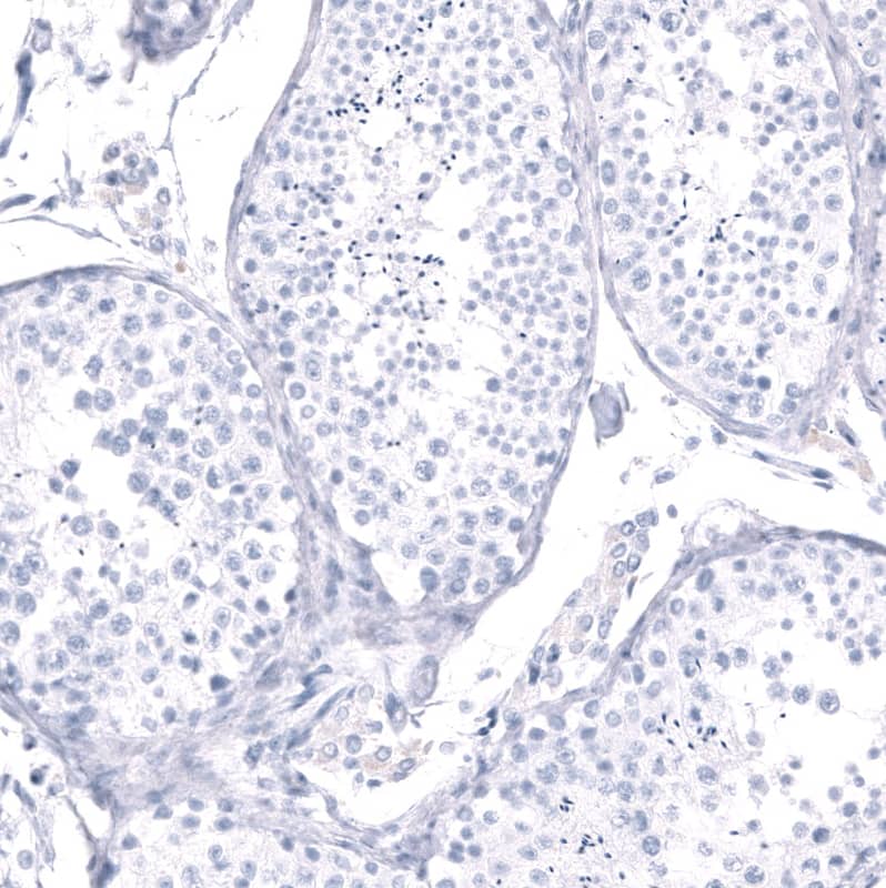 Staining of human testis shows no positivity in cells in seminiferous ducts as expected.
