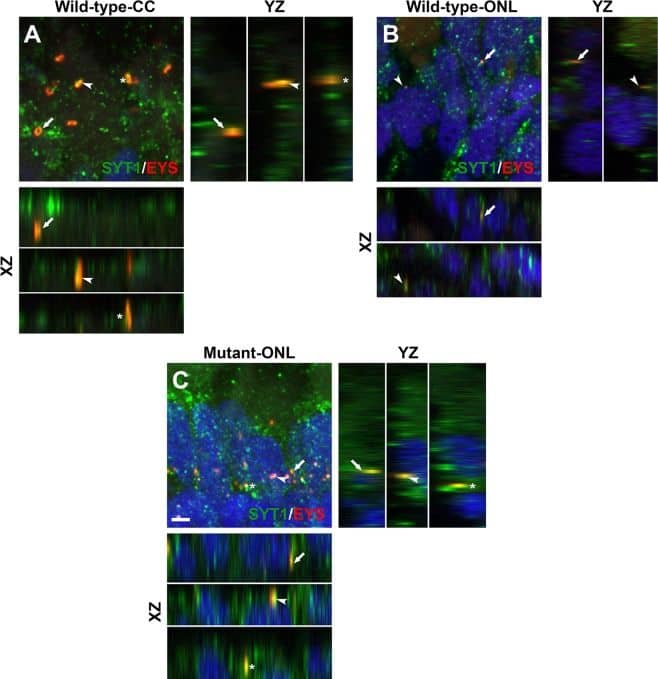 Immunocytochemistry/ Immunofluorescence EYS/RP25 Antibody