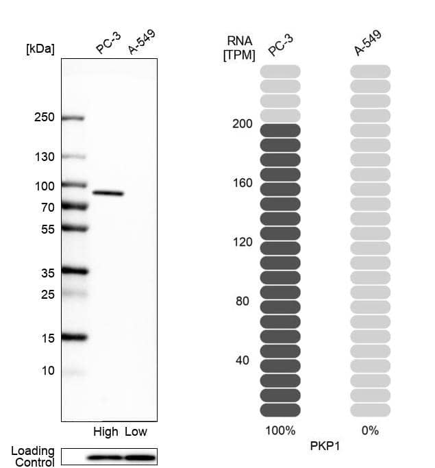 Western Blot Plakophilin 1 Antibody - BSA Free