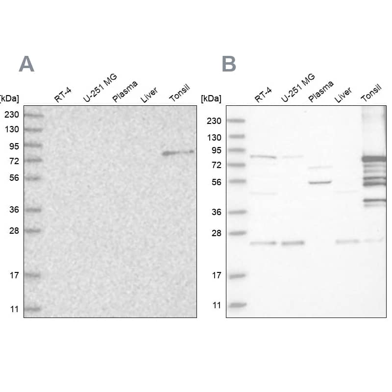 Western Blot Plakophilin 1 Antibody - BSA Free