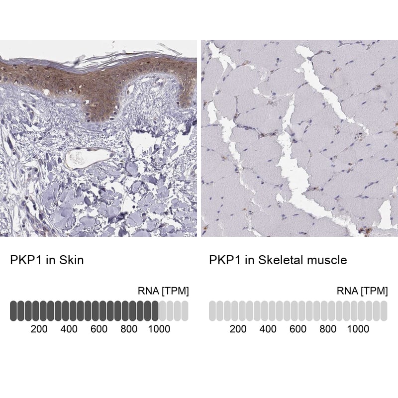 Immunohistochemistry-Paraffin Plakophilin 1 Antibody - BSA Free
