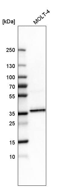 Analysis in human cell line MOLT-4.