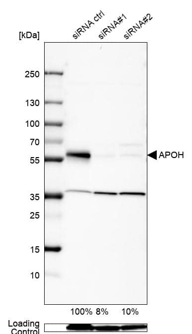 Analysis in Caco-2 cells transfected with control siRNA, target specific siRNA probe #1 and #2. Remaining relative intensity is presented. Loading control: Anti-GAPDH.