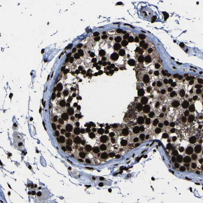 Staining of human testis shows moderate to strong nuclear positivity in cells in seminiferous ducts.