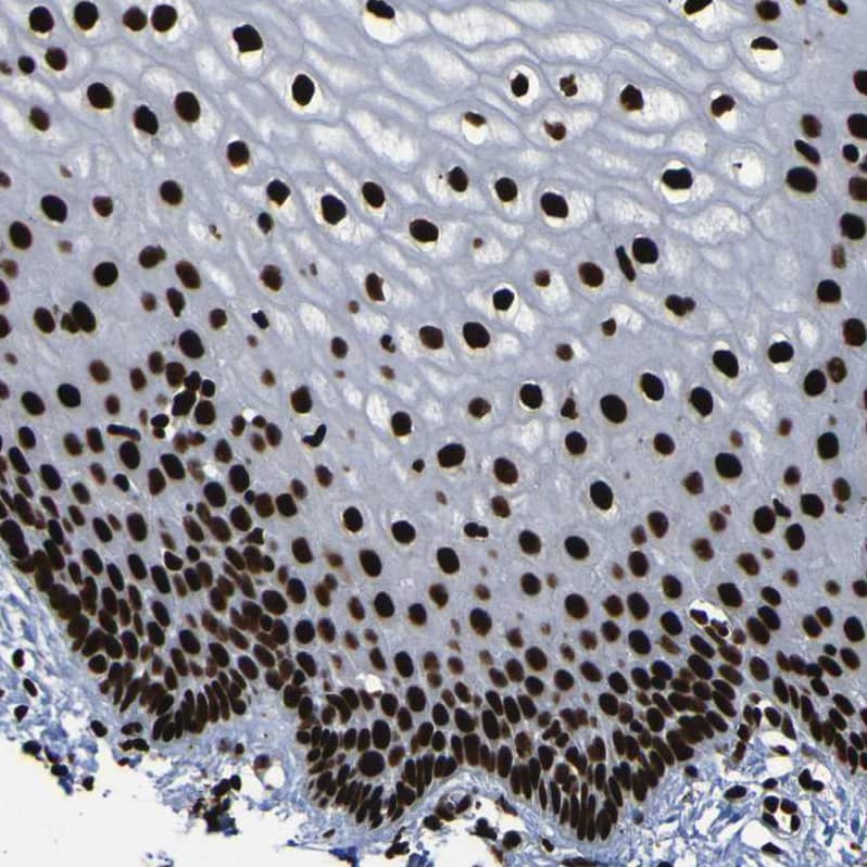 Staining of human cervix, uterine shows moderate to strong nuclear positivity in glandular cells.