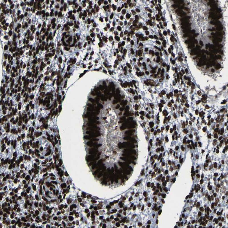 Staining of human endometrium shows moderate to strong nuclear positivity in glandular cells.