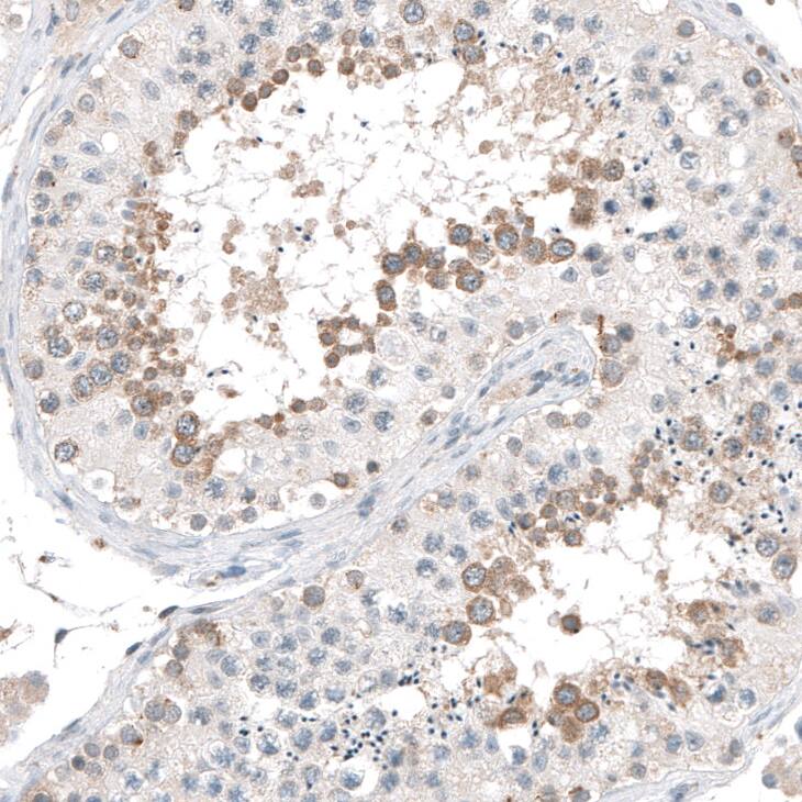 Staining of human testis shows cytoplasmic positivity in cells in seminiferous ducts.