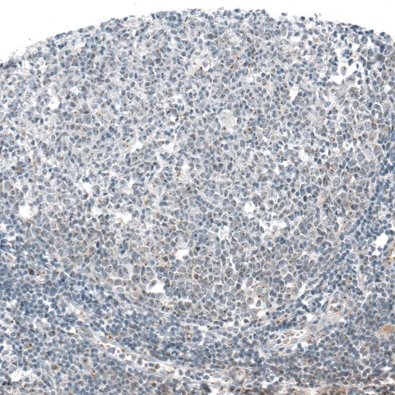 Staining of human tonsil shows positivity in lymphoid cells.