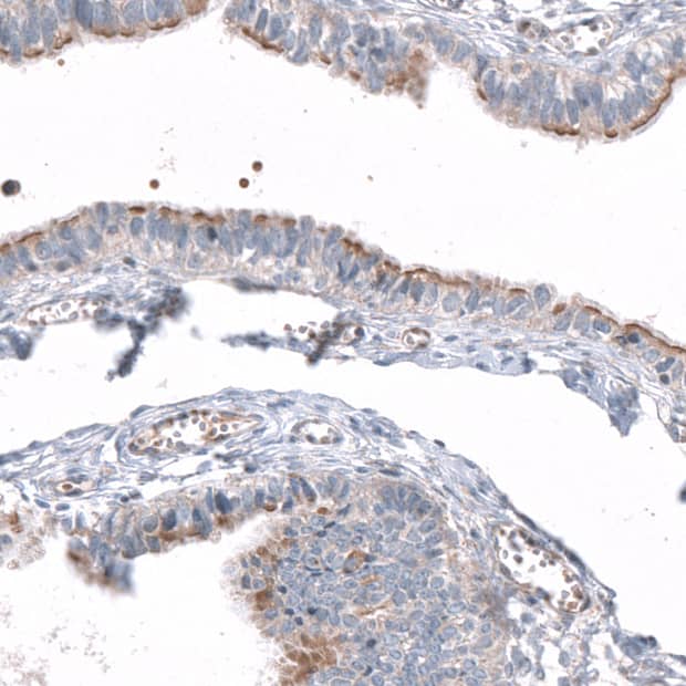 Staining of human fallopian tube shows positivity in cilia in glandular cells.