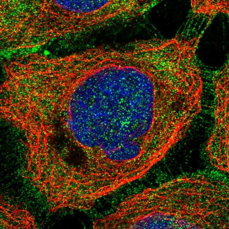 Staining of human cell line A-431 shows localization to plasma membrane & cytosol.