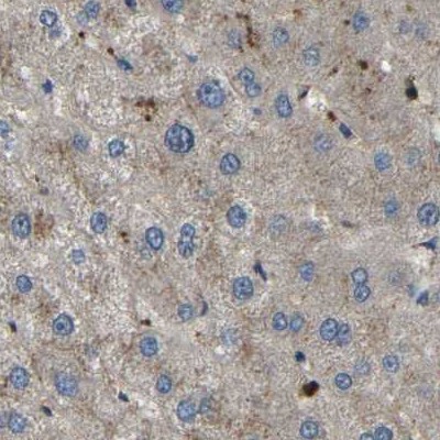 Staining of human liver.
