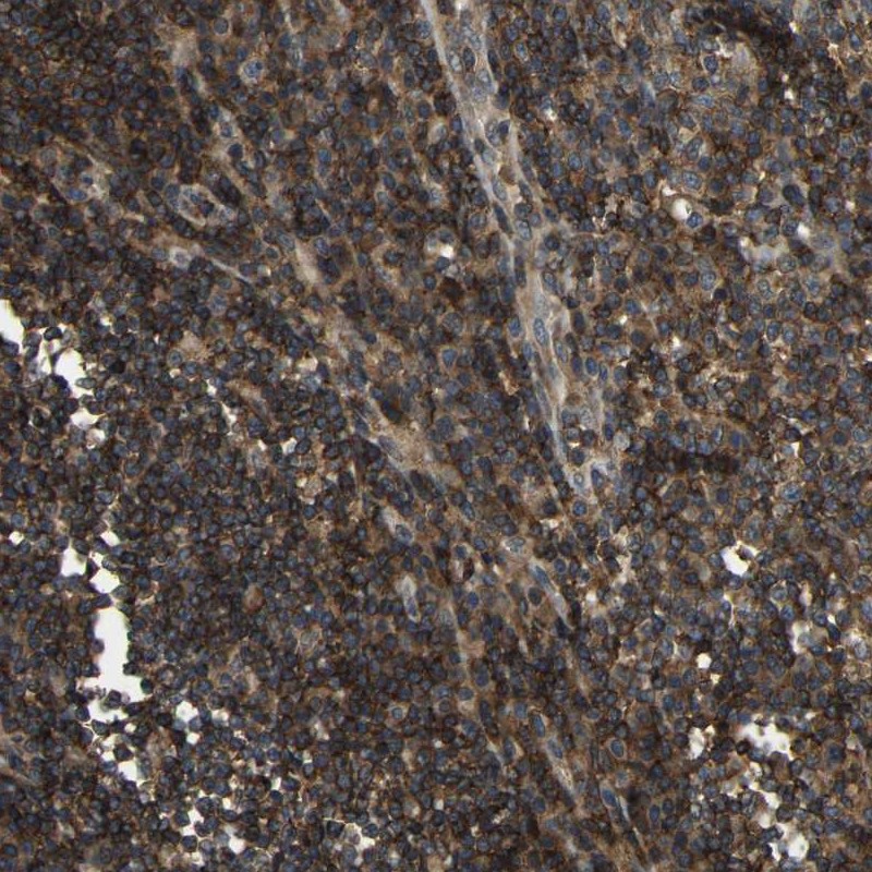 Staining of human lymph node shows low expression as expected.