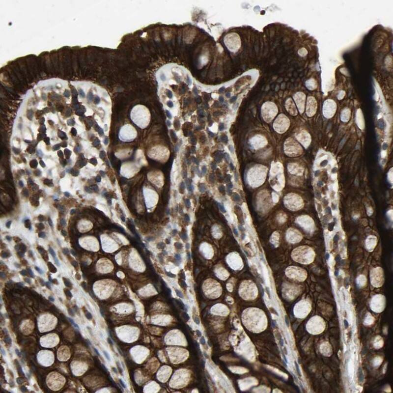 Staining of human rectum shows high expression.