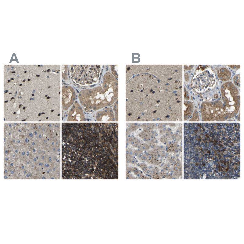 Staining of human cerebral cortex, kidney, liver and lymph node HPA018673 (A) shows similar protein distribution across tissues to independent antibody HPA018674 (B).
