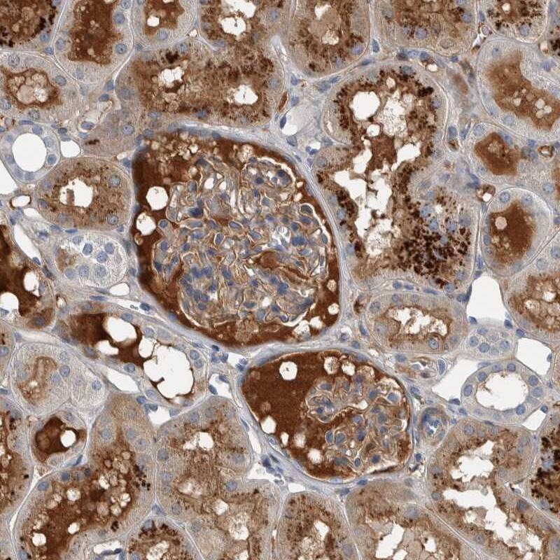 Staining of human kidney shows distinct positivity in plasma.