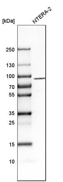 Analysis in human cell line NTERA-2.