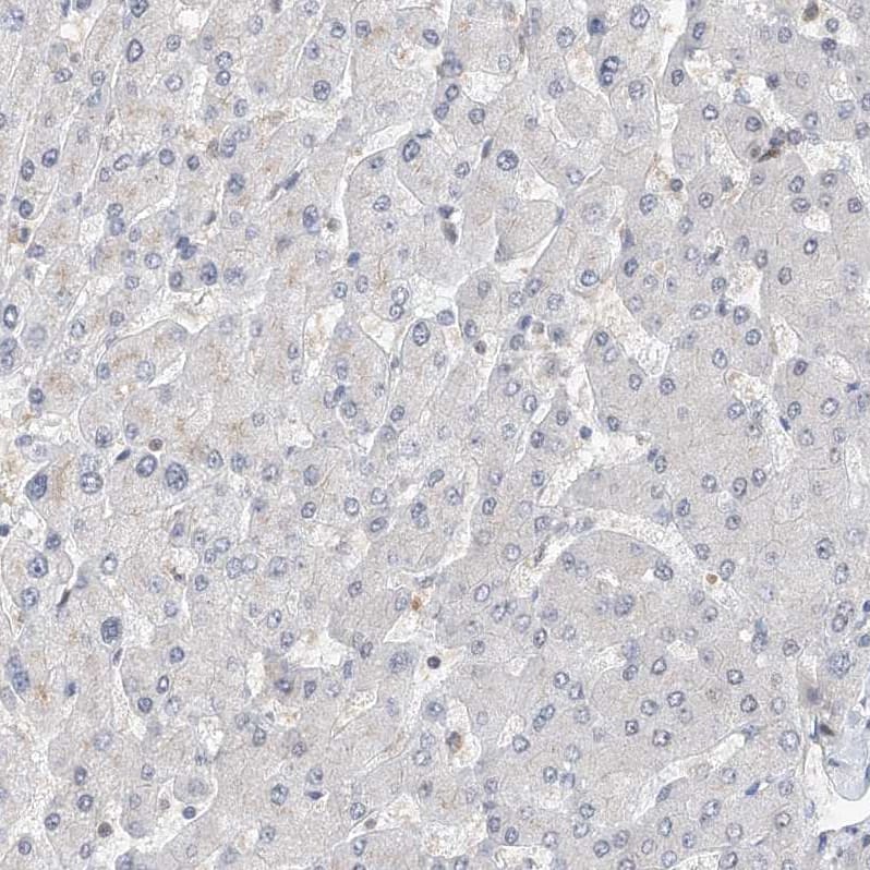 Staining of human liver shows no positivity in hepatocytes as expected.