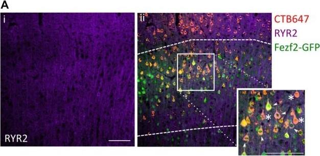 Validation of enriched RYR2 expression in Fezf2+ve IT-PNs by immunohistochemistry. Coronal sections from CTB647 injected Fezf2-Gfp mouse were labeled for Ryanodine receptor 2 (RYR2) expression and images captured in M1. (Ai) RYR2 expression in M1. (ii) Image shows co-expression of RYR2 (purple) with Fezf2+ve IT-PNs (green and red; arrowhead) and Fezf2−ve IT-PNs (red; asterisk). Dashed lines indicate layer 5 from which cells were selected for quantification. Scale bar is 100 μm. (B) Normalized percentage area of cell body labeled for RYR2 expression in Fezf2+ve and Fezf2−ve IT-PNs. There is a significant decrease of RYR2 protein expression in Fezf2−ve IT-PN cell bodies (p < 0.05, paired t-test, n = 3; +/- SEM). Image collected and cropped by CiteAb from the following open publication (//pubmed.ncbi.nlm.nih.gov/30483051), licensed under a CC-BY license. Not internally tested by Novus Biologicals.