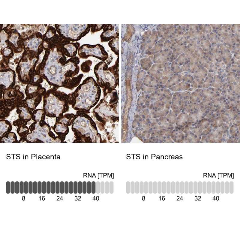 Immunohistochemistry-Paraffin Steroid sulfatase Antibody - BSA Free