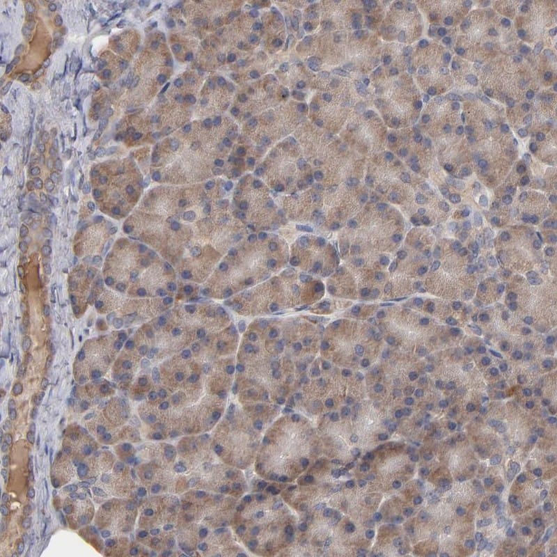 Immunohistochemistry-Paraffin Steroid sulfatase Antibody - BSA Free