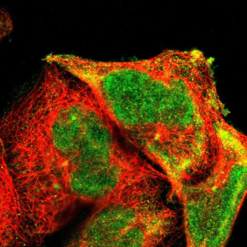 Staining of human cell line A-431 shows localization to nucleus, cytosol & centrosome.