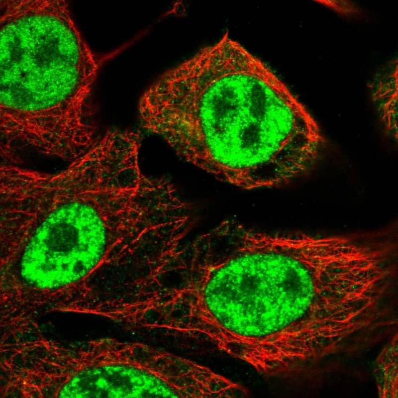 Staining of human cell line A-431 shows localization to nuclear speckles.