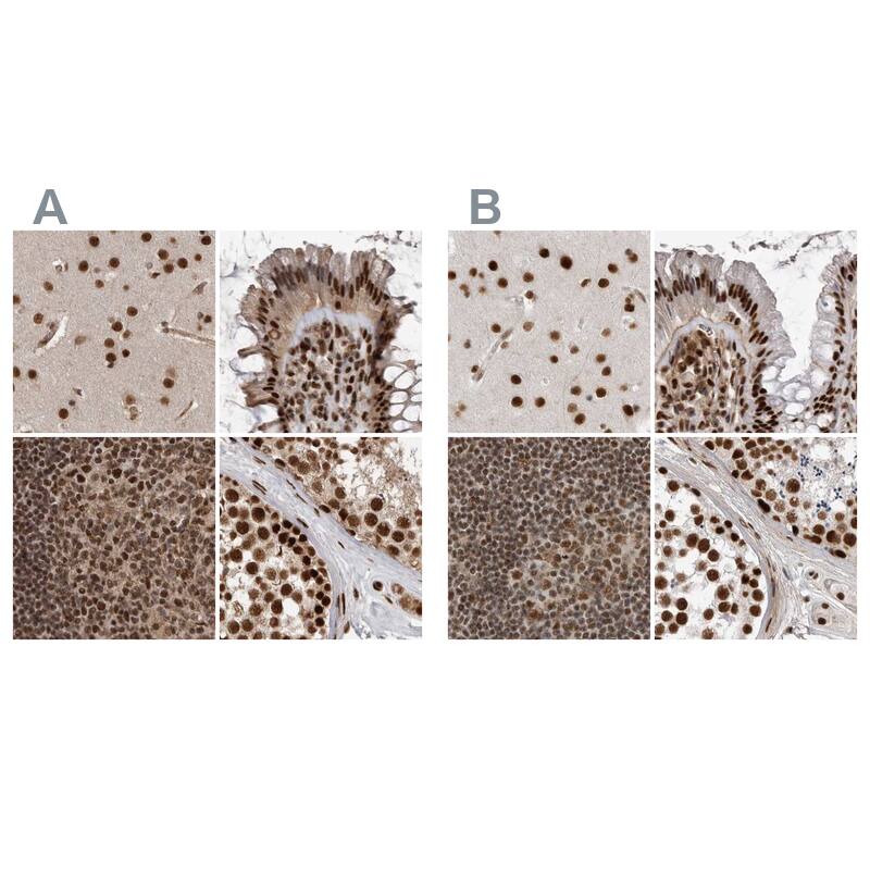 <b>Independent Antibodies Validation. </b>Staining of human cerebral cortex, colon, lymph node and testis using NBP1-90111 (A) shows similar protein distribution across tissues to independent antibody NBP1-90113 (B).