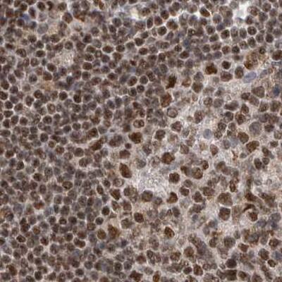 Staining of human lymph node.