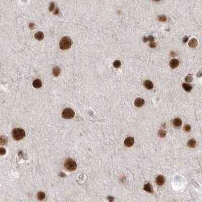 Staining of human cerebral cortex.