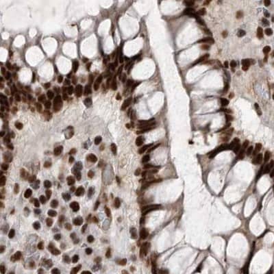 Staining of human colon.