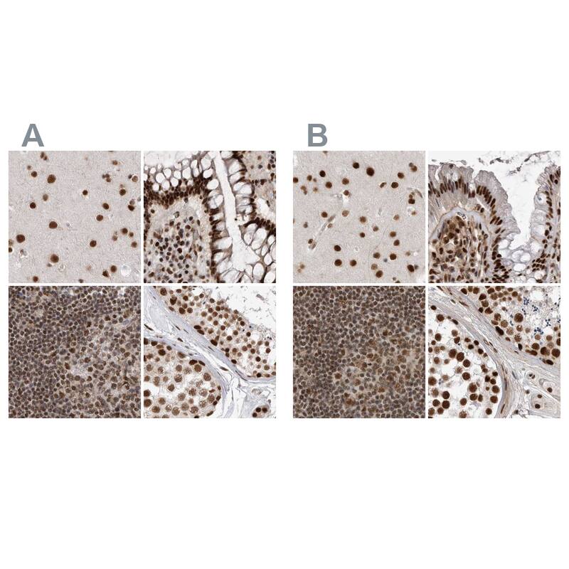 <b>Orthogonal Strategies Validation. </b>Staining of human cerebral cortex, colon, lymph node and testis HPA027417 (A) shows similar protein distribution across tissues to independent antibody HPA027406 (B).