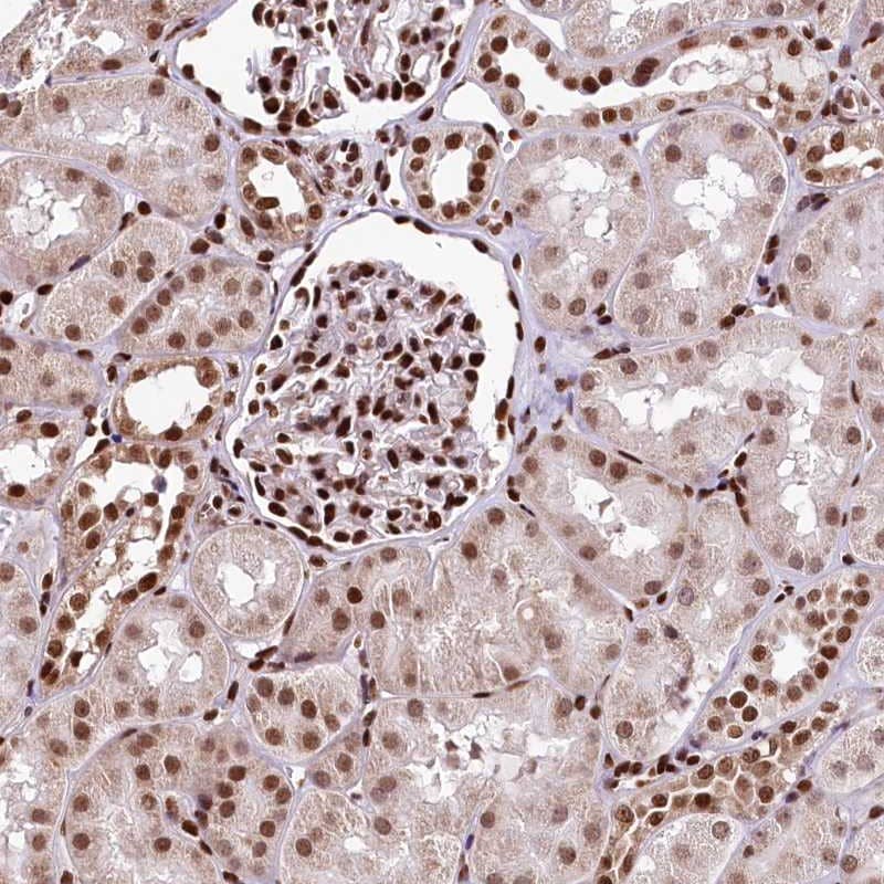 Staining of human kidney shows strong nuclear positivity in cells in tubules and cells in glomeruli.