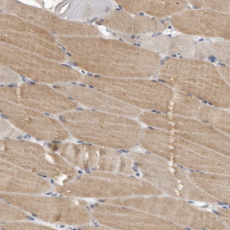 Staining of human skeletal muscle shows distinct positivity in myocytes.