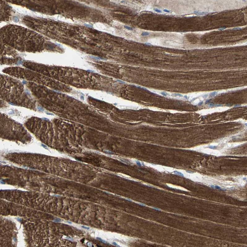 Staining of human skeletal muscle shows strong granular cytoplasmic positivity in myocytes.