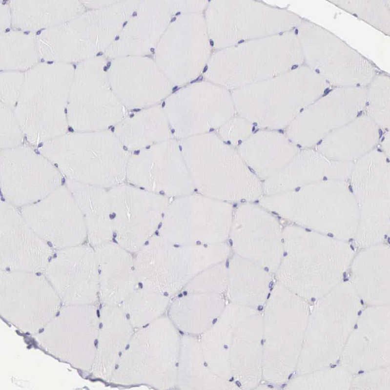 Staining of human skeletal muscle shows no positivity in myocytes as expected.