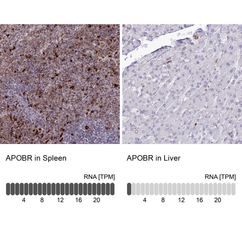 <b>Independent Antibodies Validation and Orthogonal Strategies Validation.</b>Analysis in human spleen and liver tissues using Anti-APOBR antibody. Corresponding APOBR RNA-seq data are presented for the same tissues.