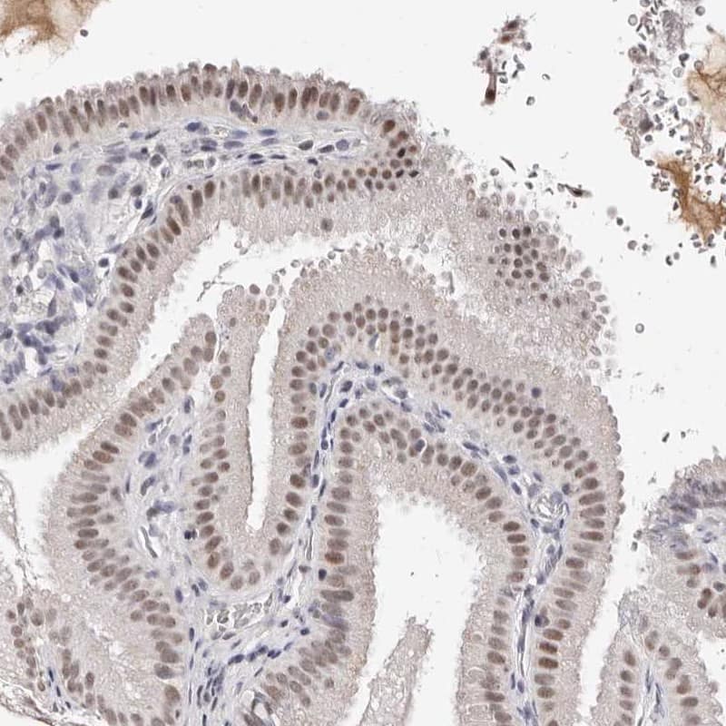 Staining of human gallbladder shows nuclear positivity in glandular cells.