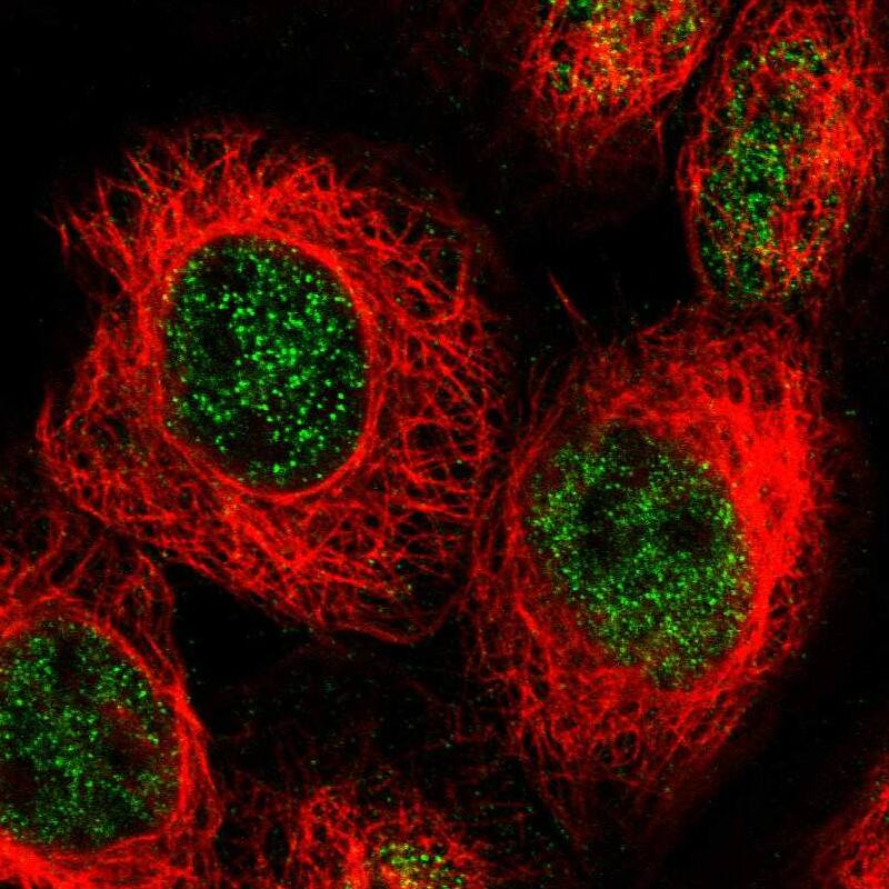 Staining of human cell line A-431 shows localization to nucleoplasm.