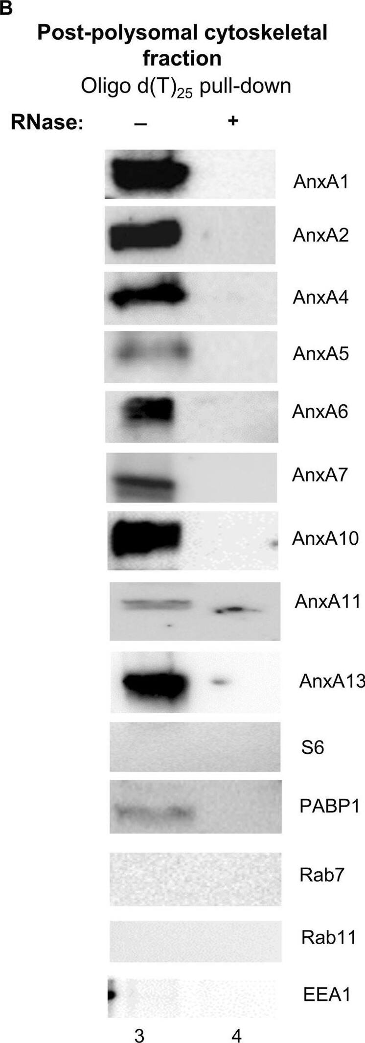 AnxA1, AnxA2, AnxA4, AnxA5, AnxA6, AnxA7, AnxA10, AnxA11 and AnxA13 present in the cytoskeleton fraction (Panel A) are associated with non-polysomal mRNP complexes (Panel B) of PC12 cells. Panel (A) 30 ug of the cytoskeletal fraction (lane 1) and cytoskeleton-bound polysomes (lane 2) were separated by 10% SDS-PAGE and transferred to nitrocellulose membranes. Panel (B) samples prepared from oligo (dT)-bound mRNP complexes from the cytoskeletal fraction [supernatant after centrifugation for 2 h 100,000 g above a 1 M (35%) sucrose cushion] (lanes 3 and 4), without (lane 3) or with RNase (lane 4) treatment, as indicated above the Western blots, were subjected to similar analysis. The blots were probed with antibodies against the different Anxs and against PABP1 as a marker for poly(A)-containing mRNAs, as indicated. Antibodies against the ribosomal subunit S6 were used to inform of the distribution of ribosomes. In addition, the blots were probed with antibodies against early endosomes (EEA1), late endosomes (Rab7) and recycling endosomes (Rab11). SPC25 and LAMP1 were not detectable in any of the fractions (results not shown). Visualization of the immunoreactive protein bands was performed using the ChemiDocTM XRS+ molecular imager after incubation with horseradish peroxidase (HRP)-conjugated secondary antibodies and enhanced chemiluminescence (ECL)-reagent. The blots shown are representative for results from three experiments. Image collected and cropped by CiteAb from the following open publication (//pubmed.ncbi.nlm.nih.gov/37397259), licensed under a CC-BY license. Not internally tested by Novus Biologicals.