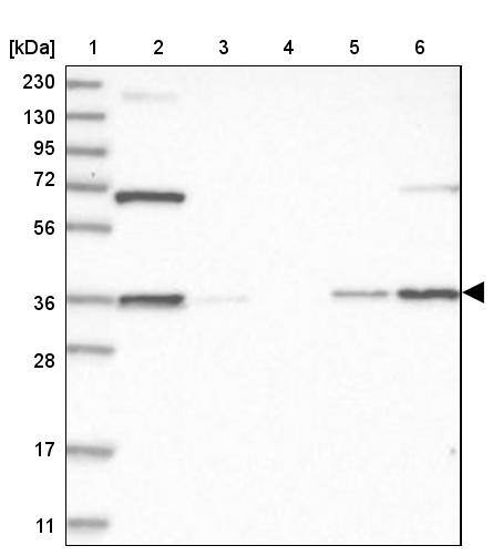 Lane 1: Marker [kDa] 230, 130, 95, 72, 56, 36, 28, 17, 11Lane 2: Human cell line RT-4Lane 3: Human cell line U-251MG spLane 4: Human plasma (IgG/HSA depleted)Lane 5: Human liver tissueLane 6: Human tonsil tissue