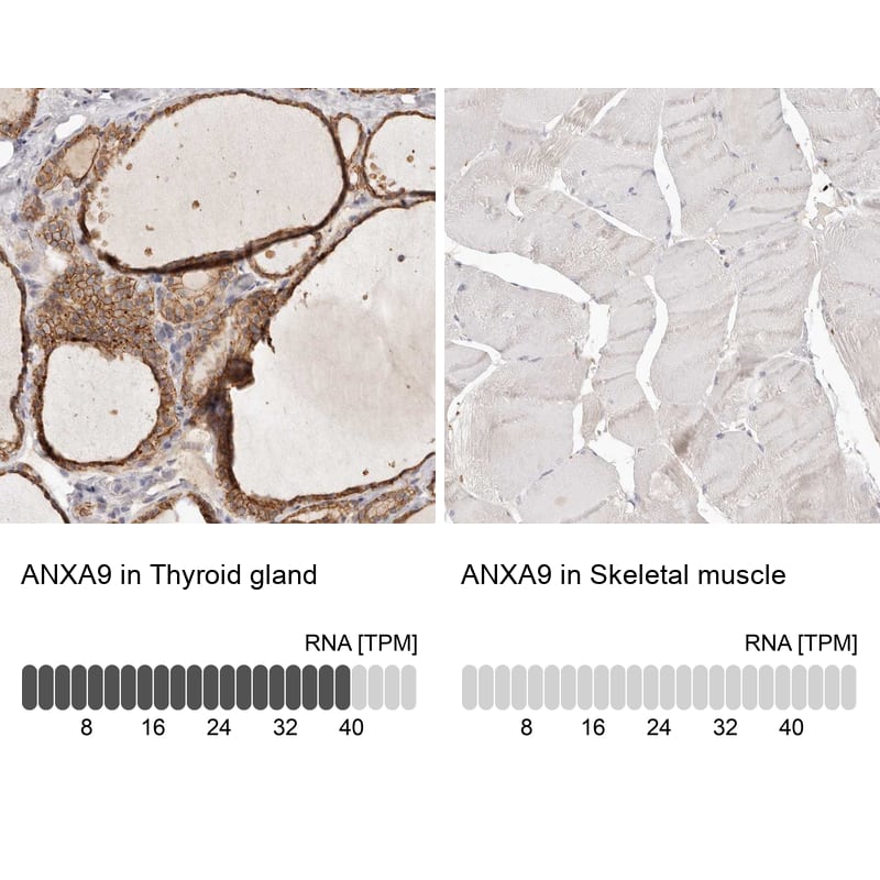 <b>Independent Antibodies Validation and Orthogonal Strategies Validation.</b>Analysis in human thyroid gland and skeletal muscle tissues using Anti-ANXA9 antibody. Corresponding ANXA9 RNA-seq data are presented for the same tissues.