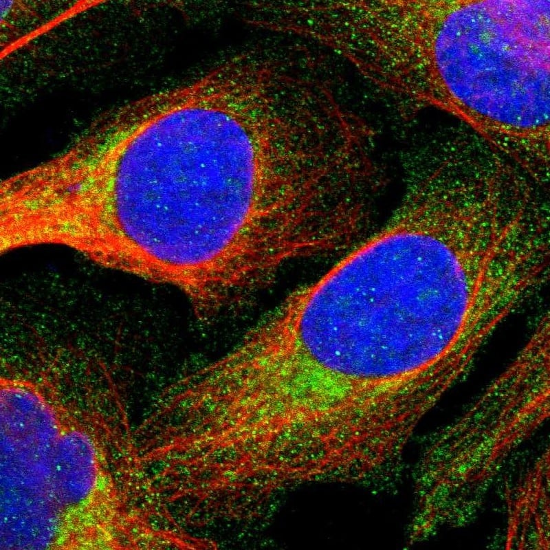 Staining of human cell line U-2 OS shows localization to cytosol.