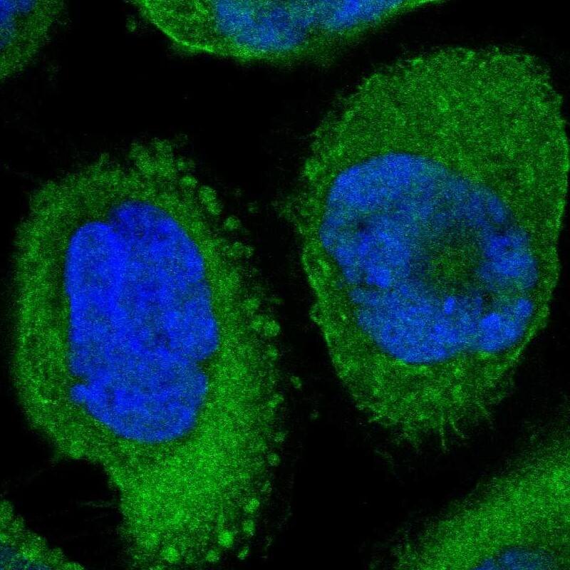Staining of human cell line A-431 shows localization to nucleoplasm, plasma membrane & cytosol.