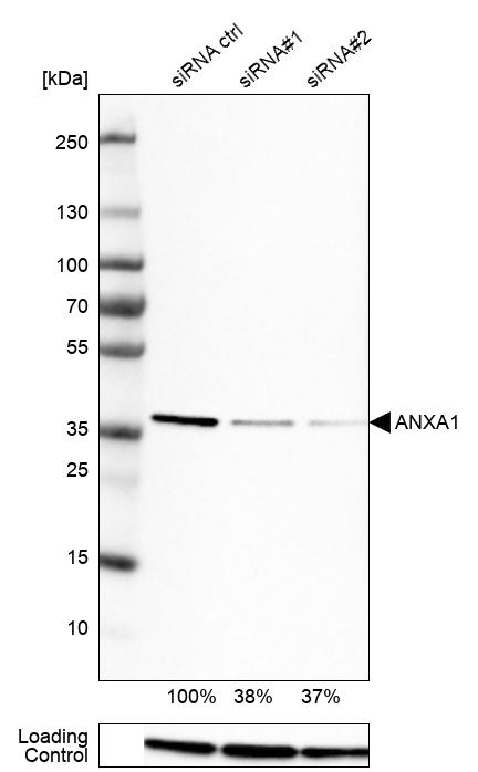 <b>Genetic Strategies Validation. </b>Analysis in U-251MG cells transfected with control siRNA, target specific siRNA probe #1 and #2. Remaining relative intensity is presented. Loading control: Anti-PPIB.
